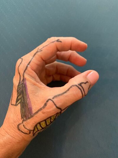 A person's hand show from the thumb side with bones drawn on it in black marker.