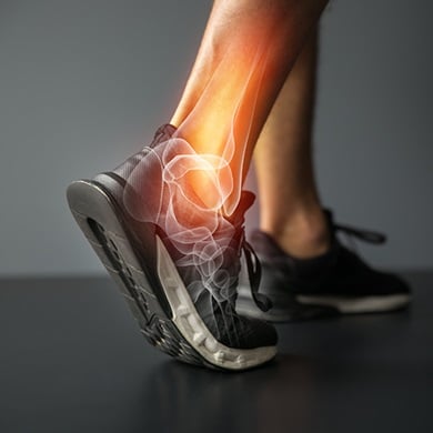 photo illustration of foot and bones